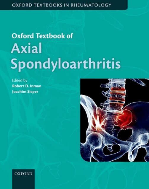 Joachim Sieper, Robert Inman - Oxford Textbook of Axial Spondyloarthritis, E-bok