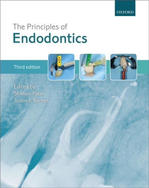 Justin J. Barnes, Shanon Patel - Principles of Endodontics, E-bok