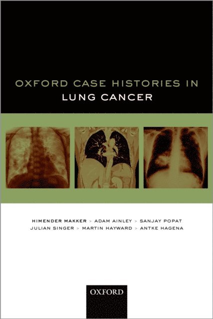 Antke Hagena, Martin Hayward, Julian Singer, Sanjay Popat, Adam Ainley, Himender K. Makker - Oxford Case Histories in Lung Cancer, E-bok