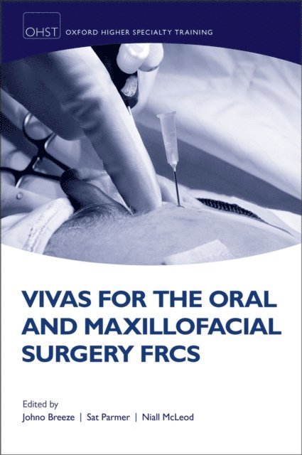 Niall MH McLeod, Sat Parmer, Johno Breeze - Vivas for the Oral and Maxillofacial Surgery FRCS, E-bok