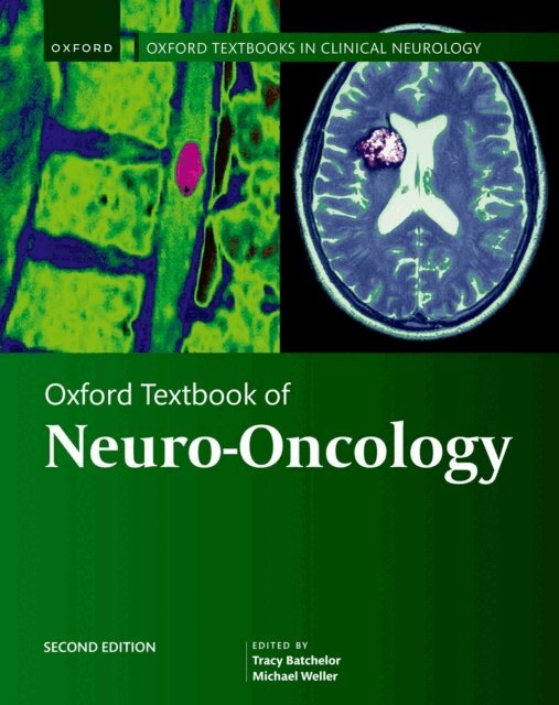 Oxford Textbook of Neuro-Oncology, E-bok