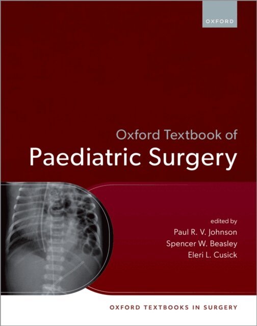 Eleri Cusick, Spencer W. Beasley, Paul R. V. Johnson - Oxford Textbook of Paediatric Surgery, E-bok