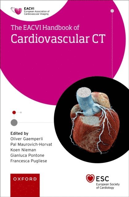 Francesca Pugliese, Gianluca Pontone, Koen Nieman, PA!l Maurovich- Horvat, Oliver Gaemperli - EACVI Handbook of Cardiovascular CT, E-bok