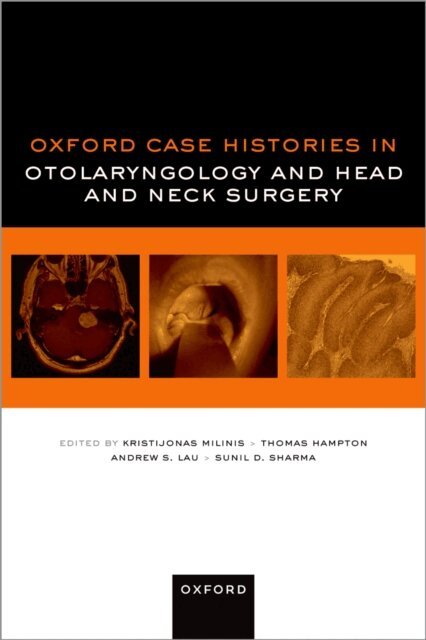 Sunil D. Sharma, Andrew S. Lau, Thomas Hampton, Kristijonas Milinis - Oxford Case Histories in Otolaryngology and Head and Neck Surgery, E-bok