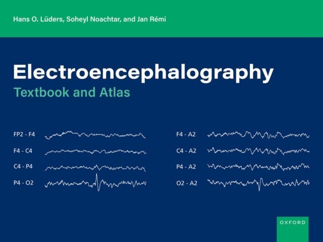 Jan RA(c)mi, Soheyl Noachtar, Hans O. LAders - Electroencephalography, E-bok