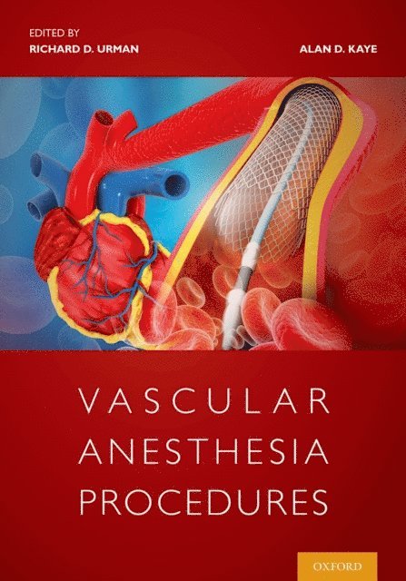 Alan Kaye, Richard Urman - Vascular Anesthesia Procedures, E-bok