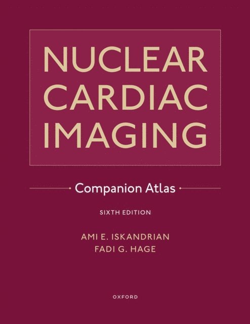 Fadi G. Hage, Ami E. Iskandrian - Nuclear Cardiac Imaging Companion Atlas, E-bok