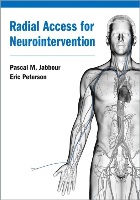 Eric Peterson, Pascal Jabbour - Radial Access for Neurointervention, E-bok