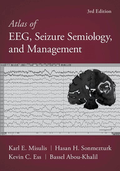 Bassel Abou-Khalil, Karl Edward Misulis, Hasan Sonmezturk, Kevin C. Ess - Atlas of EEG, Seizure Semiology, and Management, Inbunden. Tillgänglighet: Lägg i varukorg