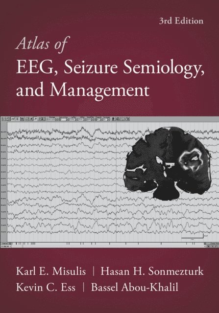 Kevin C. Ess, Hasan Sonmezturk, Karl Edward Misulis, Bassel Abou-Khalil - Atlas of EEG, Seizure Semiology, and Management, E-bok. Tillgänglighet: Lägg i varukorg