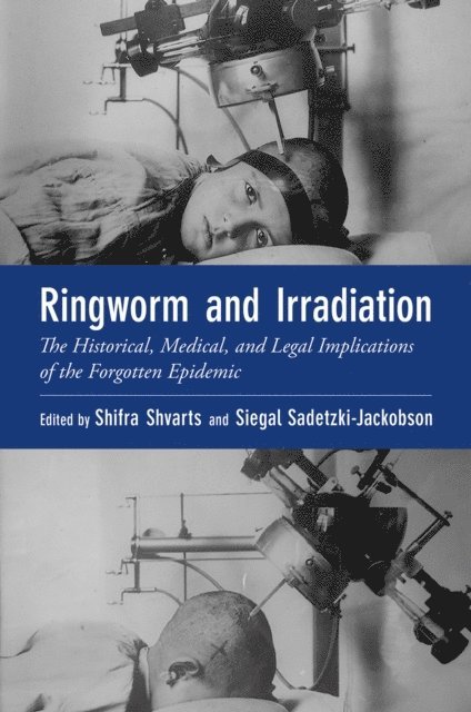 Siegal Sadetzki, Shifra Shvarts - Ringworm and Irradiation, E-bok