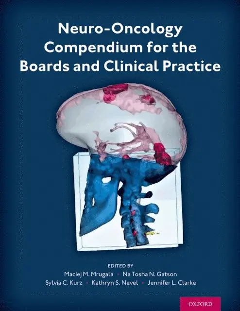Kathryn S. Nevel, Sylvia C. Kurz, Jennifer L. Clarke, Na Tosha Gatson, Maciej M. Mrugala - Neuro-Oncology Compendium for the Boards and Clinical Practice, E-bok. Tillgänglighet: Lägg i varukorg