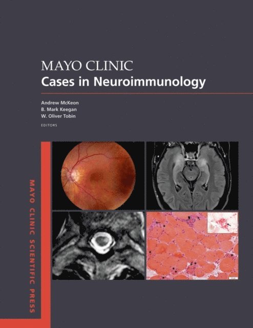 W. Oliver Tobin, B. Mark Keegan, Andrew McKeon - Mayo Clinic Cases in Neuroimmunology, E-bok