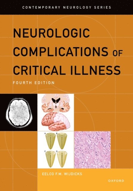 Eelco F.M. Wijdicks - Neurologic Complications of Critical Illness, E-bok