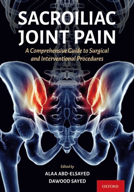 Dawood Sayed, Alaa Abd-Elsayed - Sacroiliac Joint Pain, E-bok