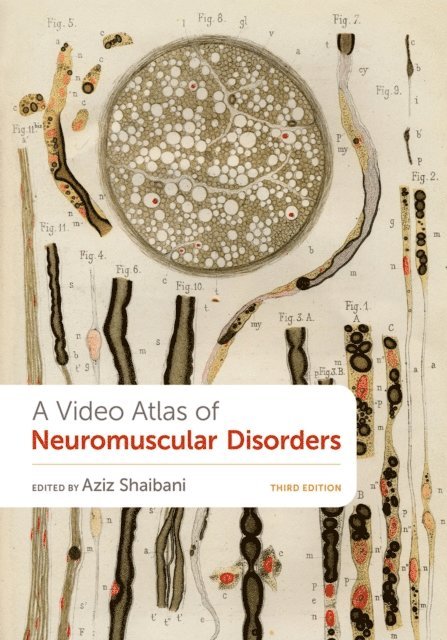 Aziz Shaibani - Video Atlas of Neuromuscular Disorders, E-bok