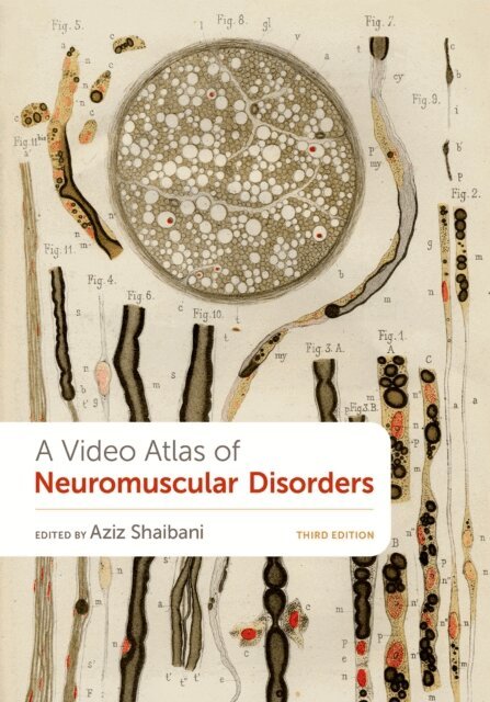 Aziz Shaibani - Video Atlas of Neuromuscular Disorders, E-bok