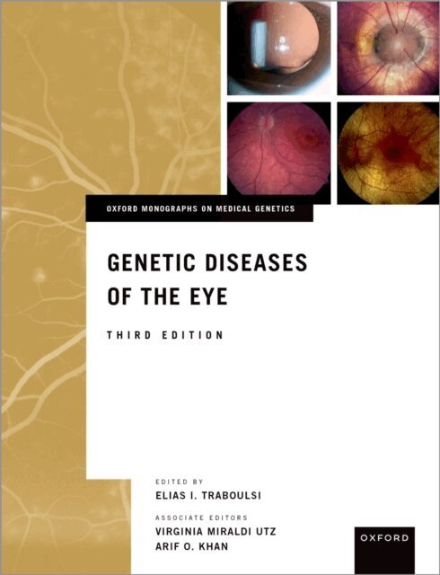 MD Arif O. Khan, MD Virginia Miraldi Utz, MD Elias I. Traboulsi MEd - Genetic Diseases of the Eye, E-bok