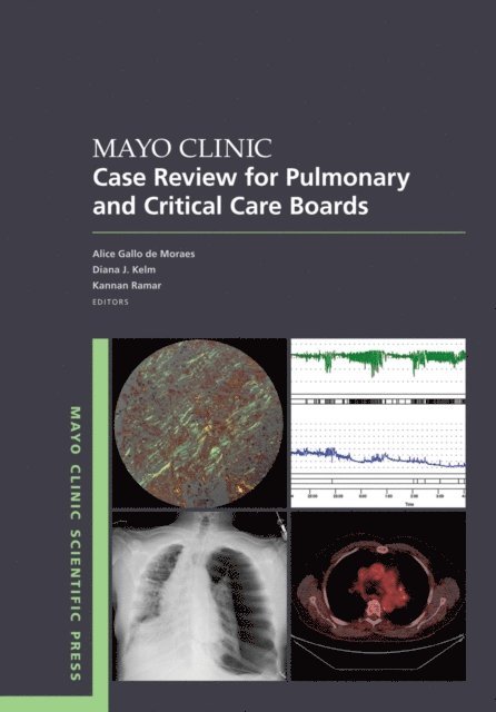 Kannan Ramar, Diana Kelm, Gallo de Moraes - Mayo Clinic Case Review for Pulmonary and Critical Care Boards, E-bok