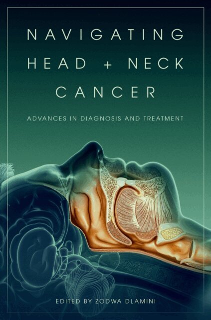 Zodwa Dlamini - Navigating Head and Neck Cancer, E-bok