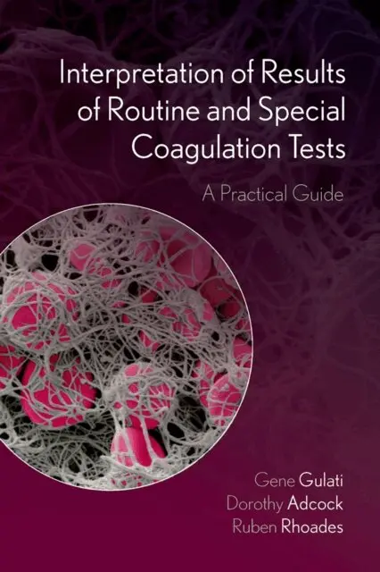 Interpretation of Results of Routine and Special Coagulation Tests