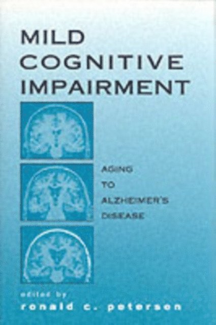 Ronald C. Petersen - Mild Cognitive Impairment, E-bok