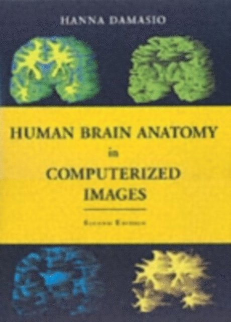Human Brain Anatomy in Computerized Images