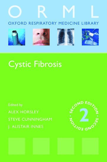 Cystic Fibrosis av Alex Horsley, Steve Cunningham, J Alastair Innes, J Alastair Innes