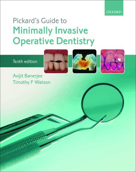 Avijit Banerjee, Timothy F. Watson - Pickard's Guide to Minimally Invasive Operative Dentistry, Häftad. Tillgänglighet: Lägg i varukorg