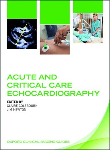 Claire Colebourn, Jim Newton - Acute and Critical Care Echocardiography, Häftad