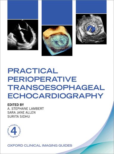 A. Stephane Lambert, Sara Jane Allen - Practical Perioperative Transoesophageal Echocardiography, Häftad