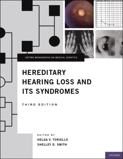 Shelley D. Smith, Helga V. Toriello - Hereditary Hearing Loss and Its Syndromes, E-bok