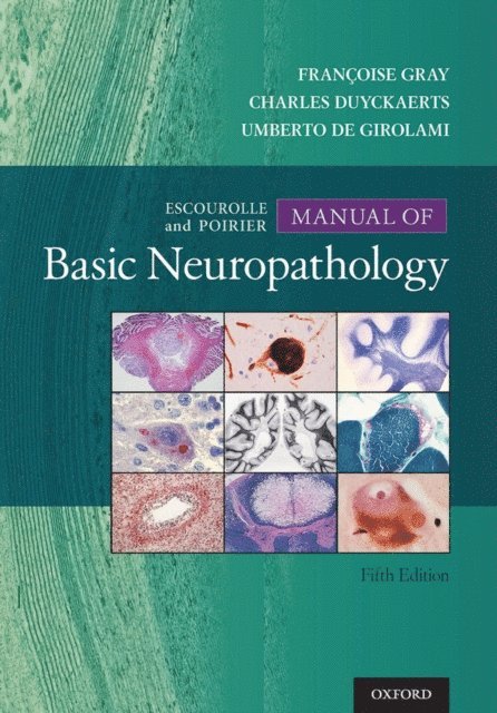 Umberto De Girolami, Charles Duyckaerts, Francoise Gray - Escourolle & Poirier's Manual of Basic Neuropathology, E-bok