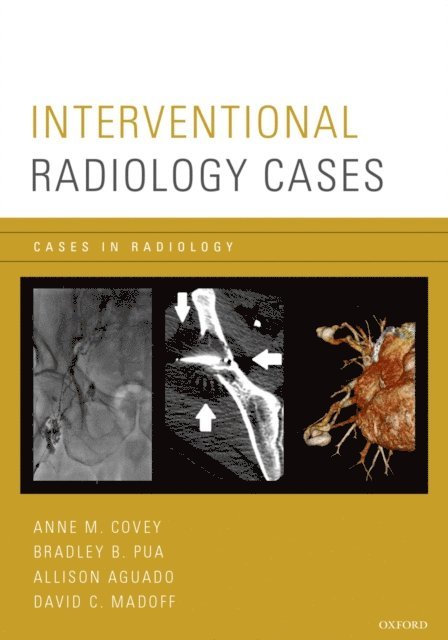 David Madoff, Allison Aguado, Bradley Pua, Anne M. Covey - Interventional Radiology Cases, E-bok