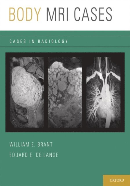 Eduard E. de Lange, William E. Brant - Body MRI Cases, E-bok