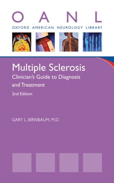Gary L. Birnbaum - Multiple Sclerosis, E-bok