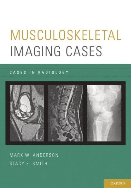 Stacy E. Smith, Mark W. Anderson - Musculoskeletal Imaging Cases, E-bok