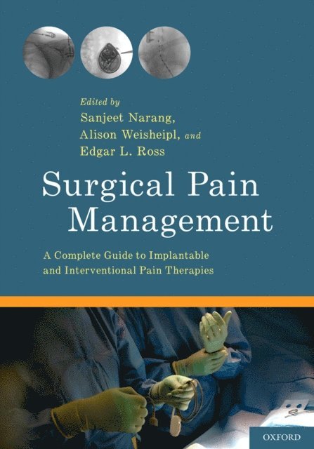 Surgical Pain Management