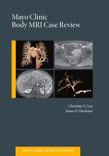 James Glockner, Christine U.C. Lee - Mayo Clinic Body MRI Case Review, E-bok