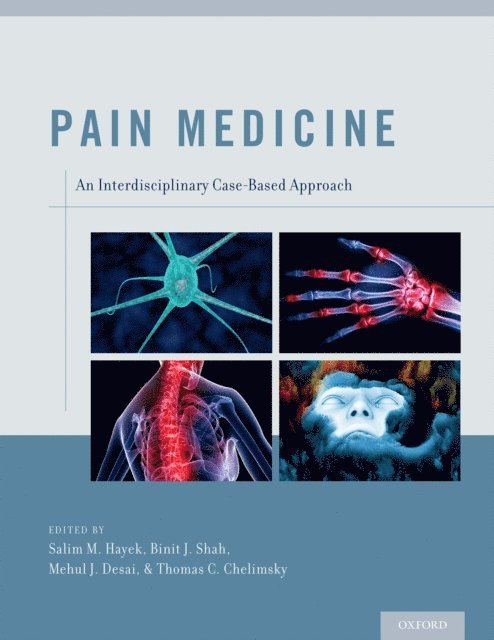 Thomas C. Chelimsky, Mehul J. Desai, Binit J. Shah, Salim M. Hayek - Pain Medicine, E-bok. Tillgänglighet: Lägg i varukorg