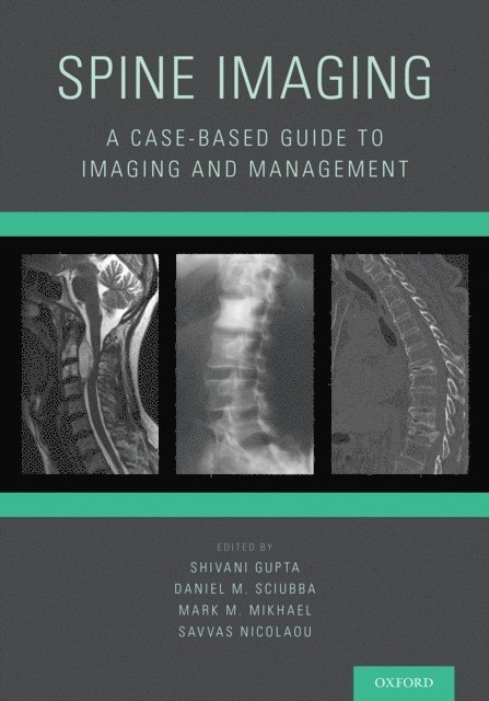 Savvas Nicolaou, Mark M. Mikhael, Daniel M. Sciubba, Shivani Gupta - Spine Imaging, E-bok
