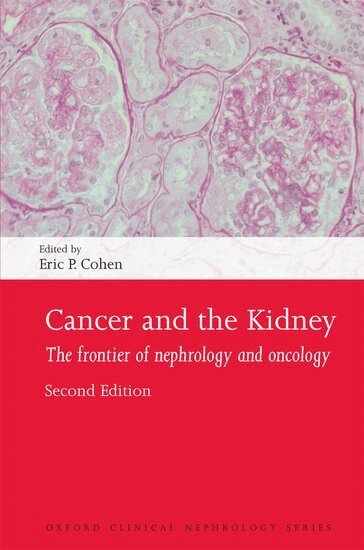 Eric P. Cohen - Cancer and the Kidney, Häftad