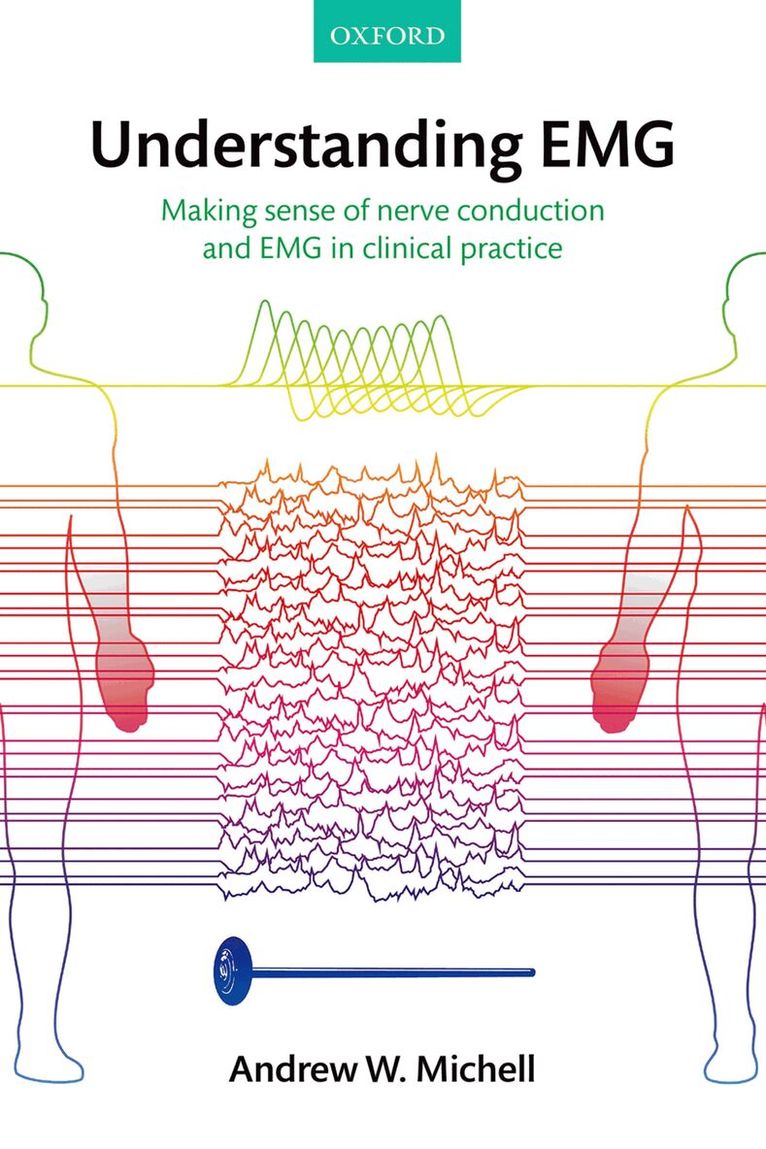 Understanding EMG