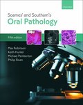 Soames' & Southam's Oral Pathology
