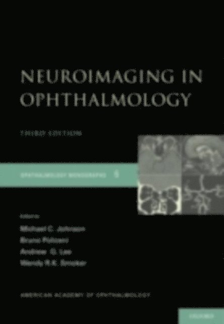 Wendy R.K. Smoker, Andrew G. Lee, Bruno Policeni, Michael C. Johnson - Neuroimaging in Ophthalmology, E-bok