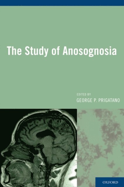 George P. Prigatano - Study of Anosognosia, E-bok