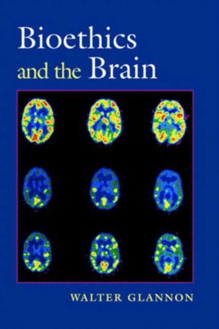 Walter Glannon - Bioethics and the Brain, E-bok