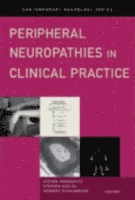 Herbert Schaumburg, Stephen Scelsa, Steven Herskovitz - Peripheral Neuropathies in Clinical Practice, E-bok