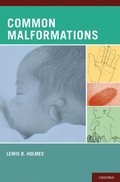 Common Malformations