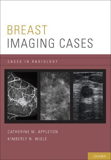 Breast Imaging Cases by Catherine M Appleton, Kimberly N Wiele, Appleton